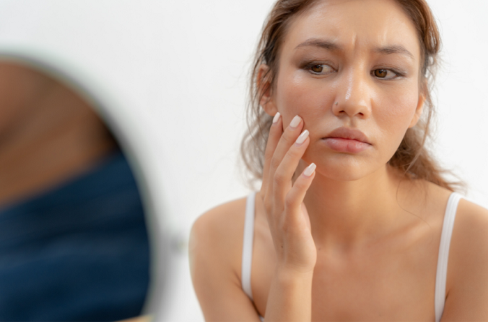 A rosacea elleni harc új dimenziója