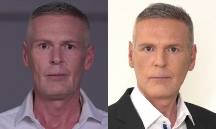 Plasztikával éveket fiatalodott a magyar James Bond – képekkel